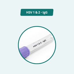 HSV 1 & 2 - IgG