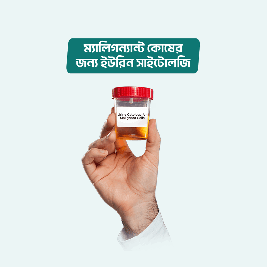 Urine Cytology for Malignant Cells