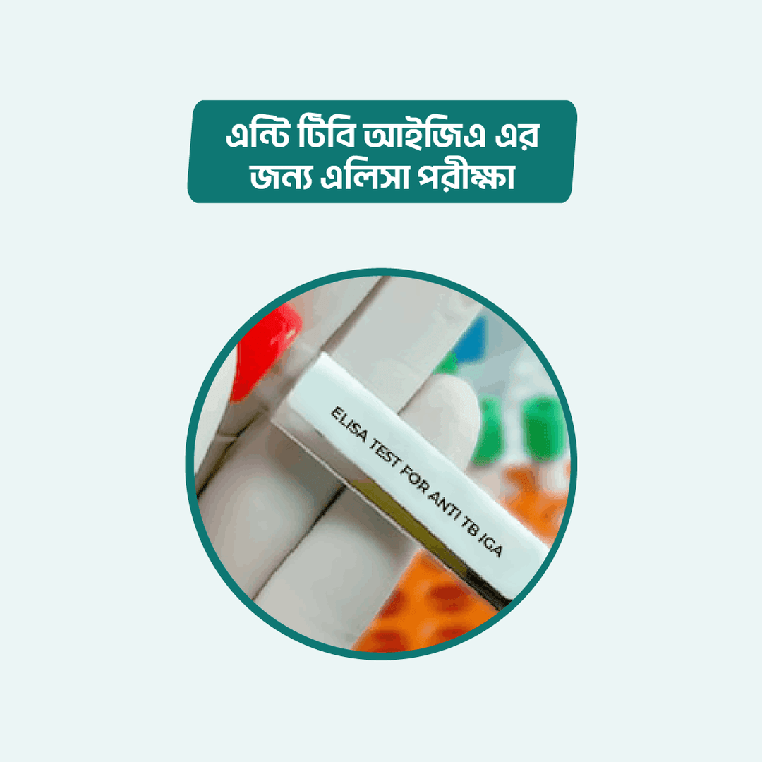 ELISA test for Anti TB IgA