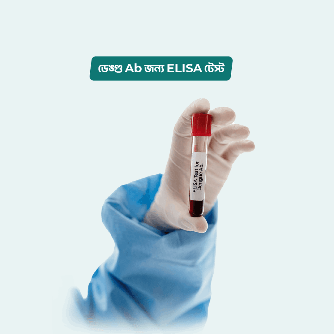 ELISA Test for Dengue Ab.
