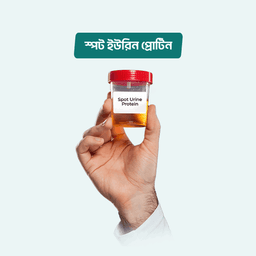 Spot Urine Protein