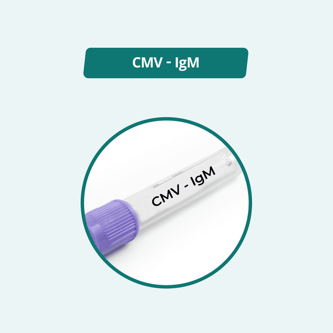 CMV - IgM