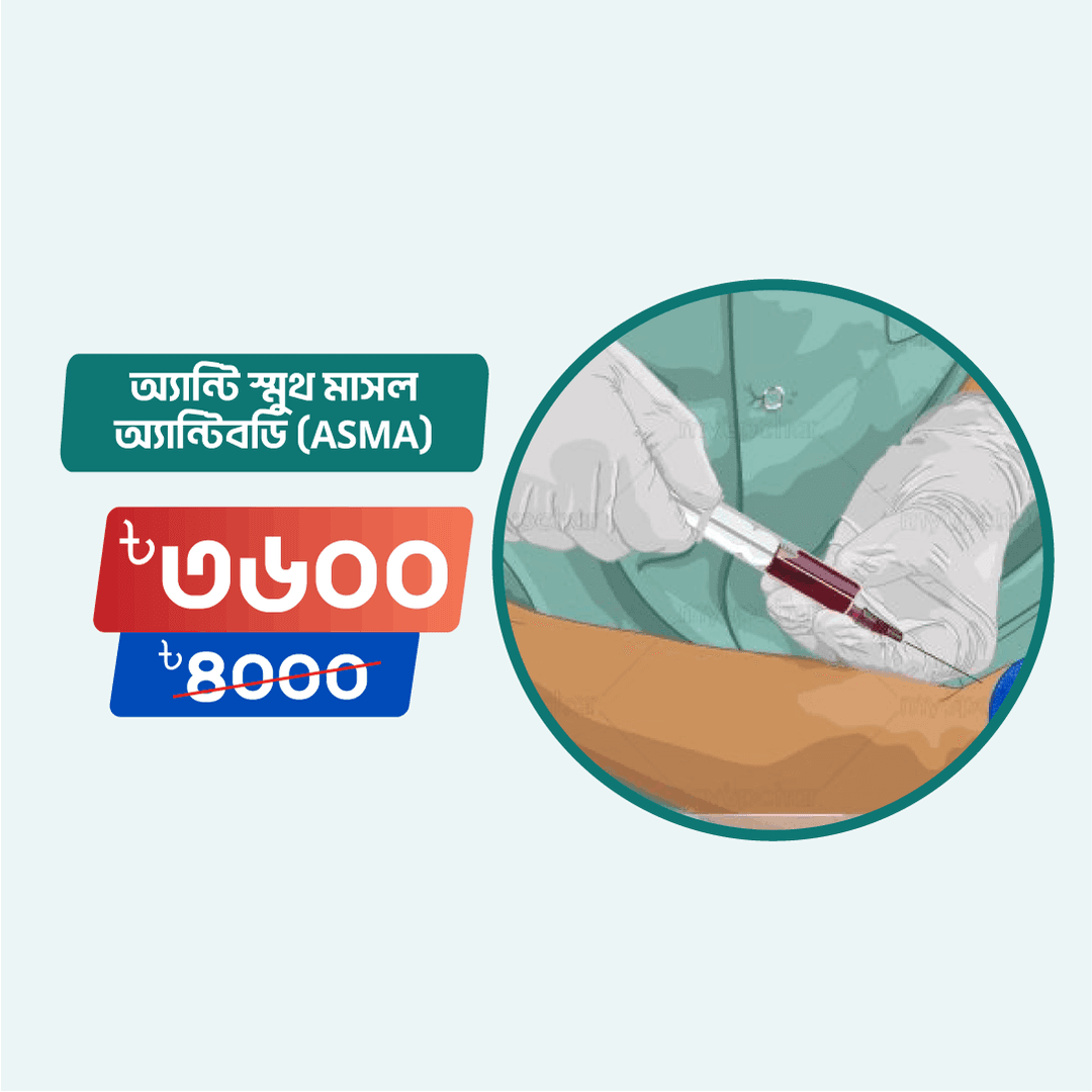 Anti Smooth Muscle Antibody (ASMA)