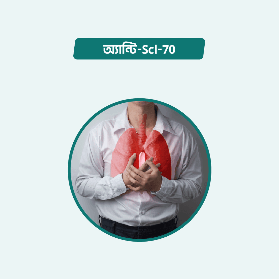 Anti Scl-70/Anti Toppoisomerasei