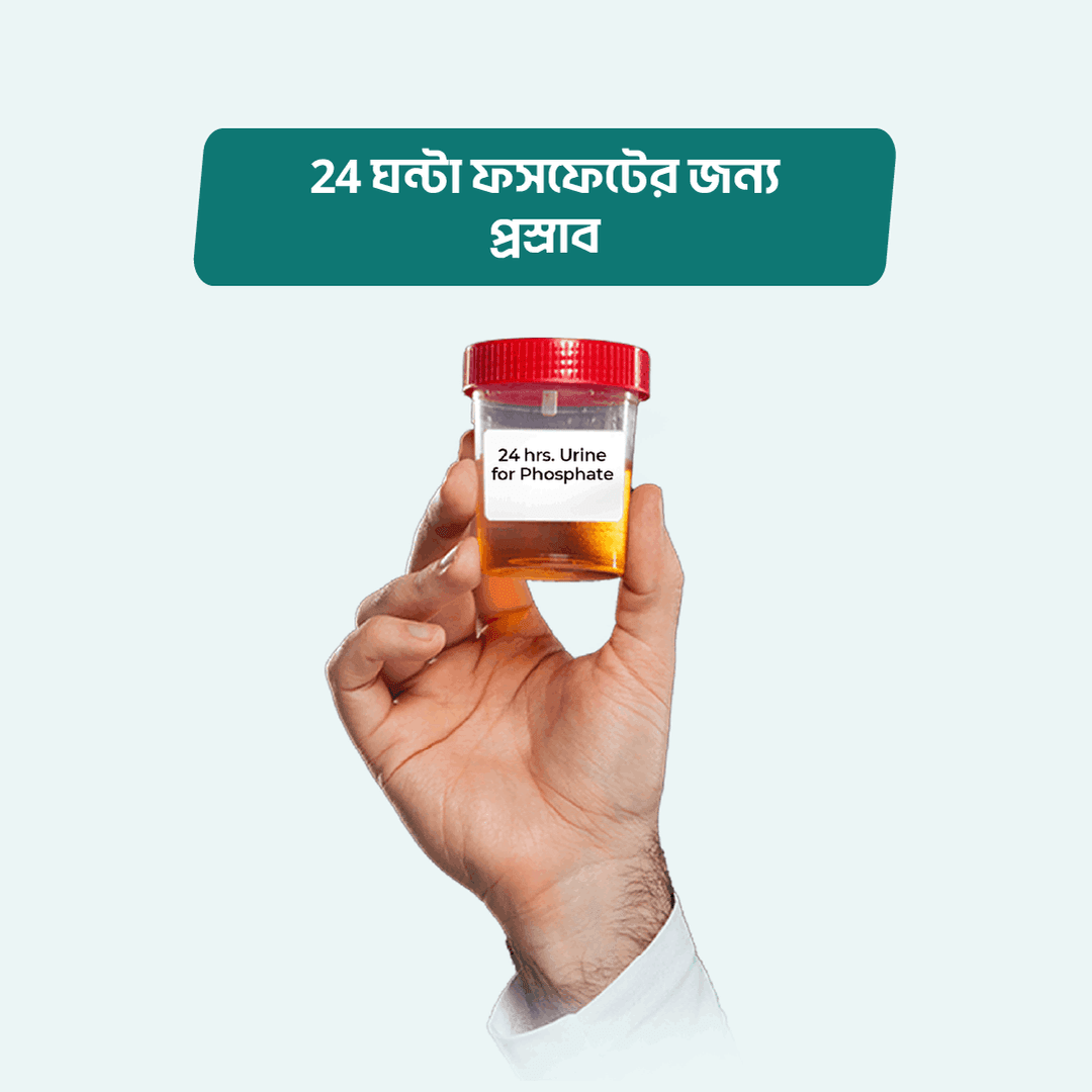 24 hrs. Urine for Phosphate