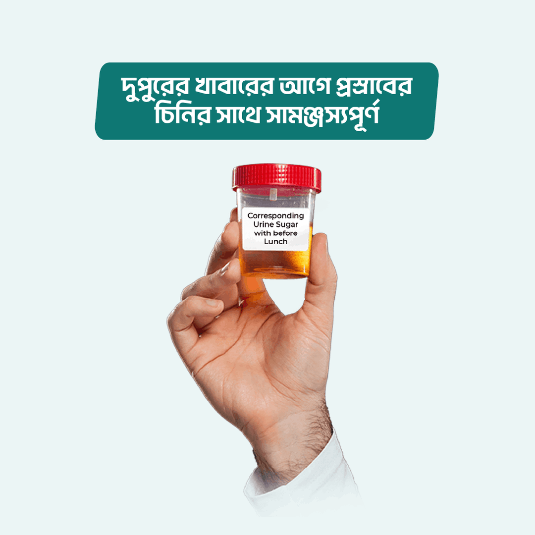 Corresponding Urine Sugar with before Lunch