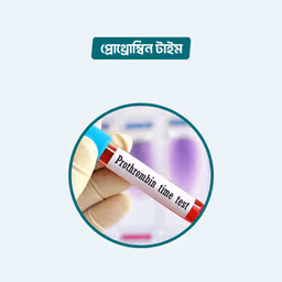 Prothrombin Time (INR)