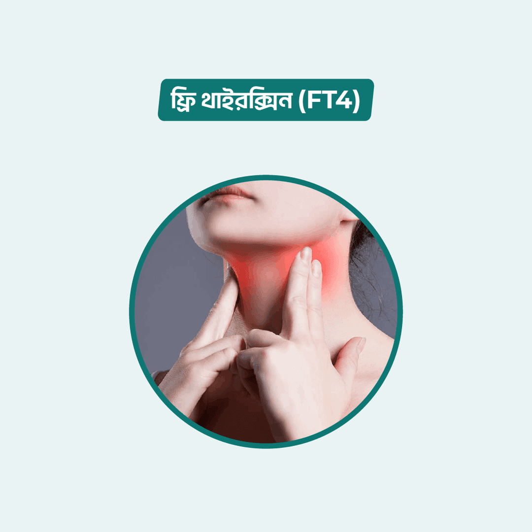 Free T4 (FT4)