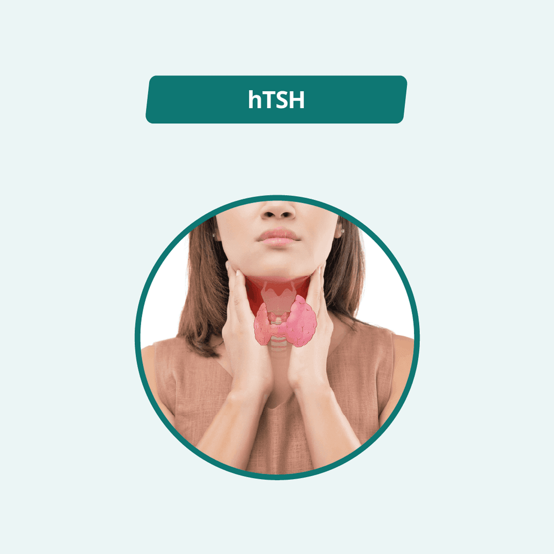 TSH