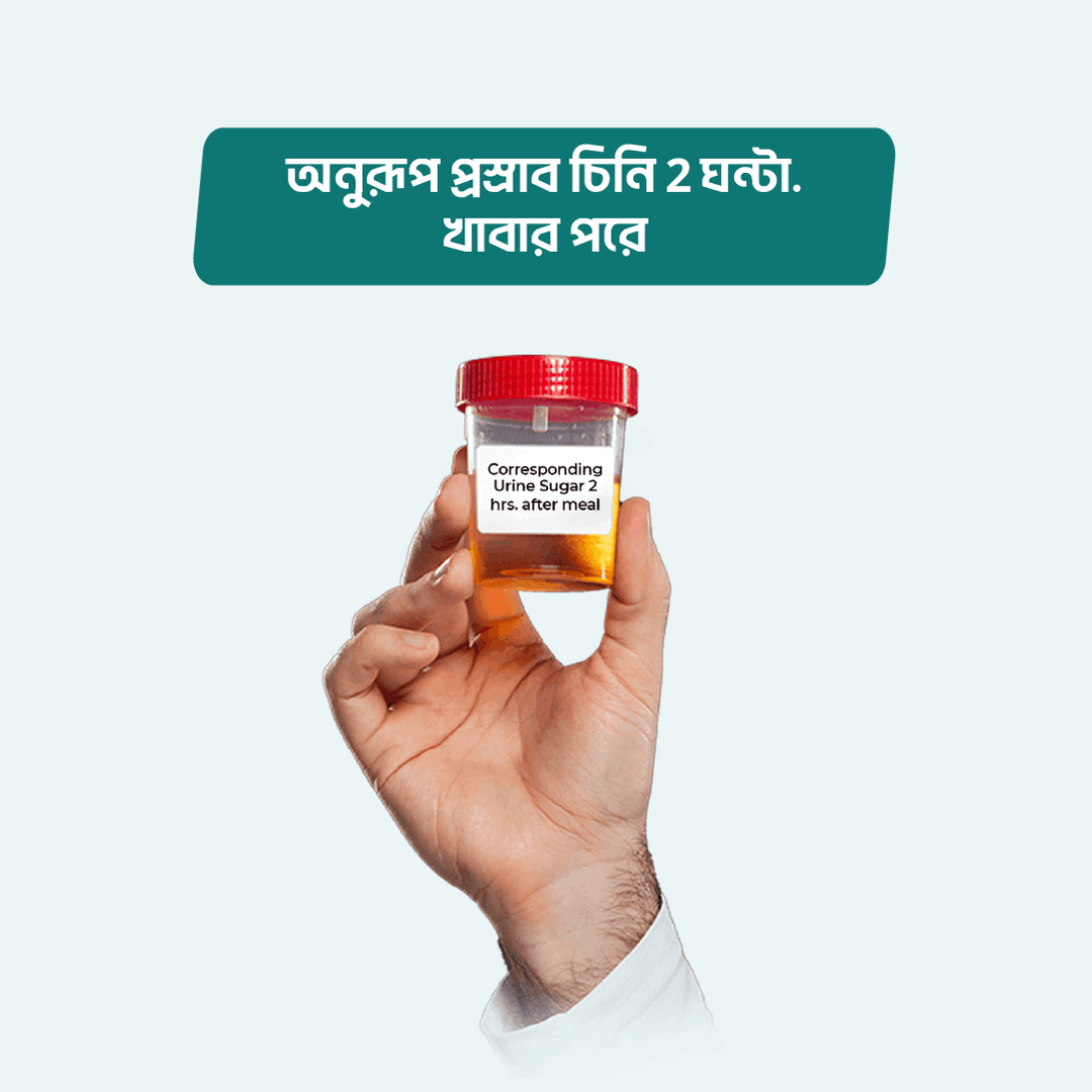 Corresponding Urine Sugar 2 hrs. after meal