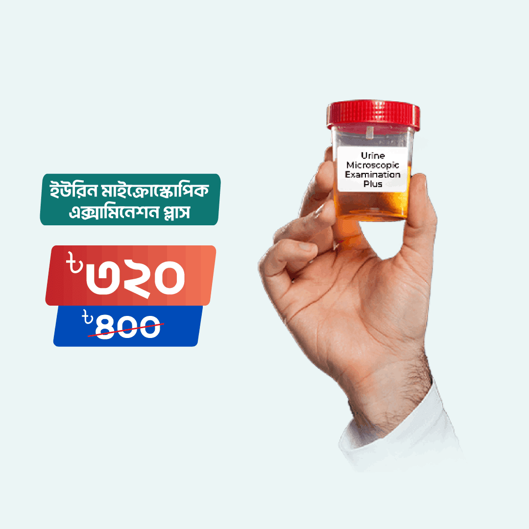 Urine Microscopic Examination Plus