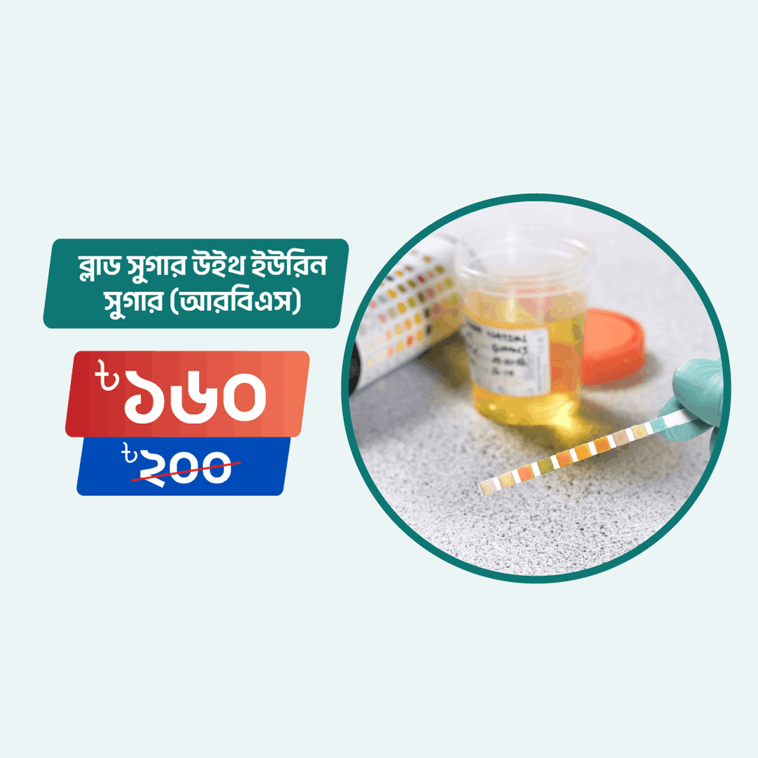 Glucose (RBS) with Corresponding Urine Sugar