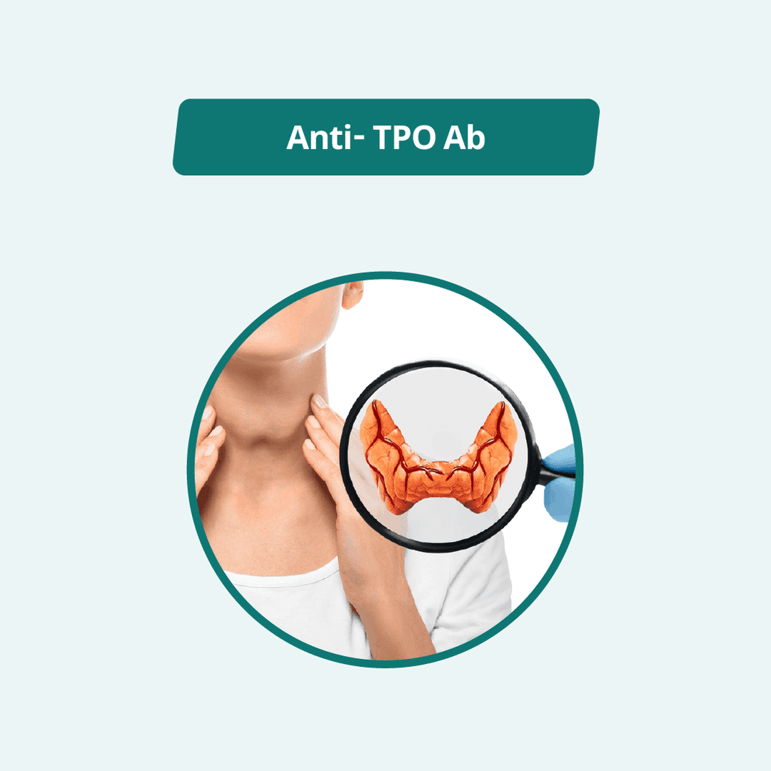 Anti- TPO Ab