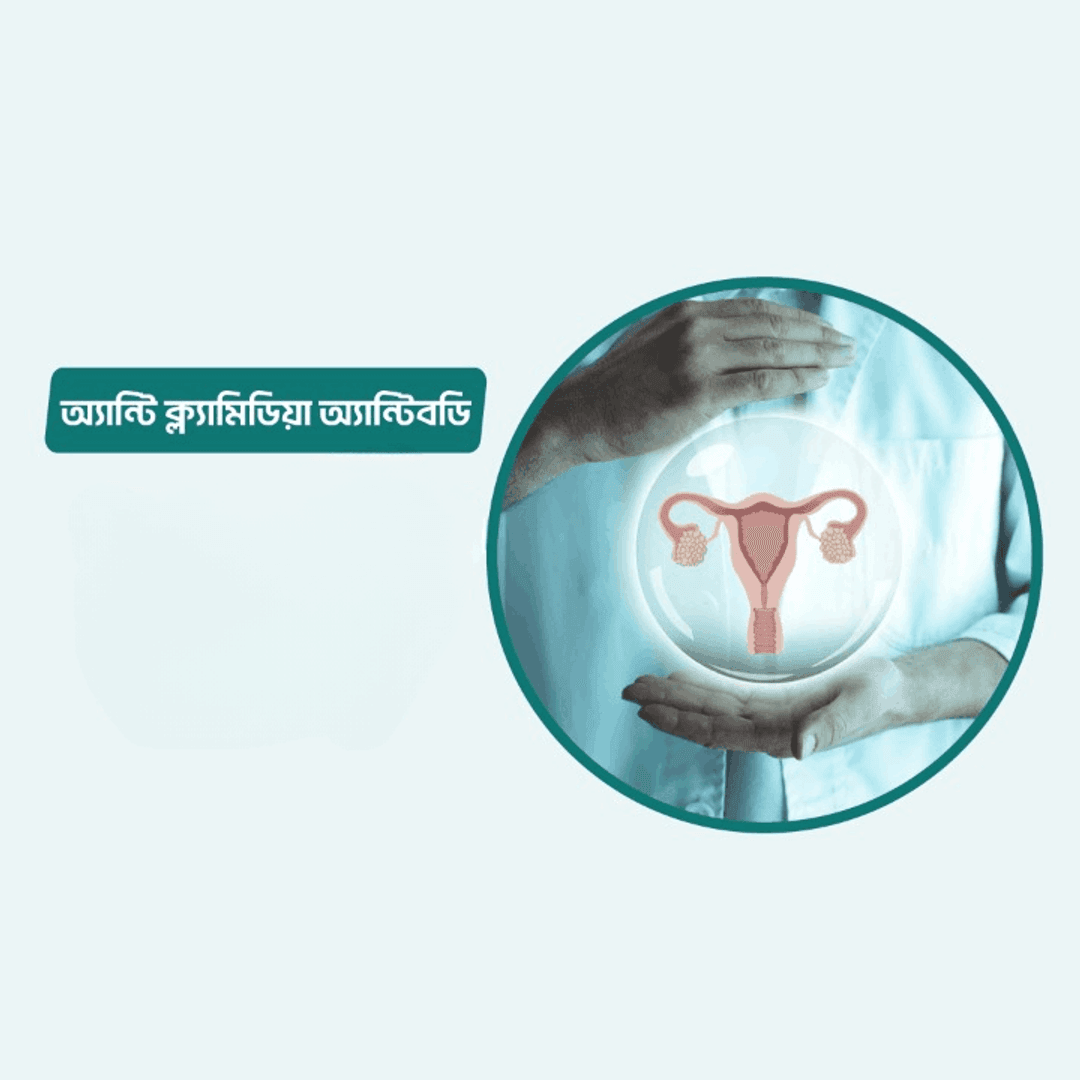 Anti Chlamydia Antibody