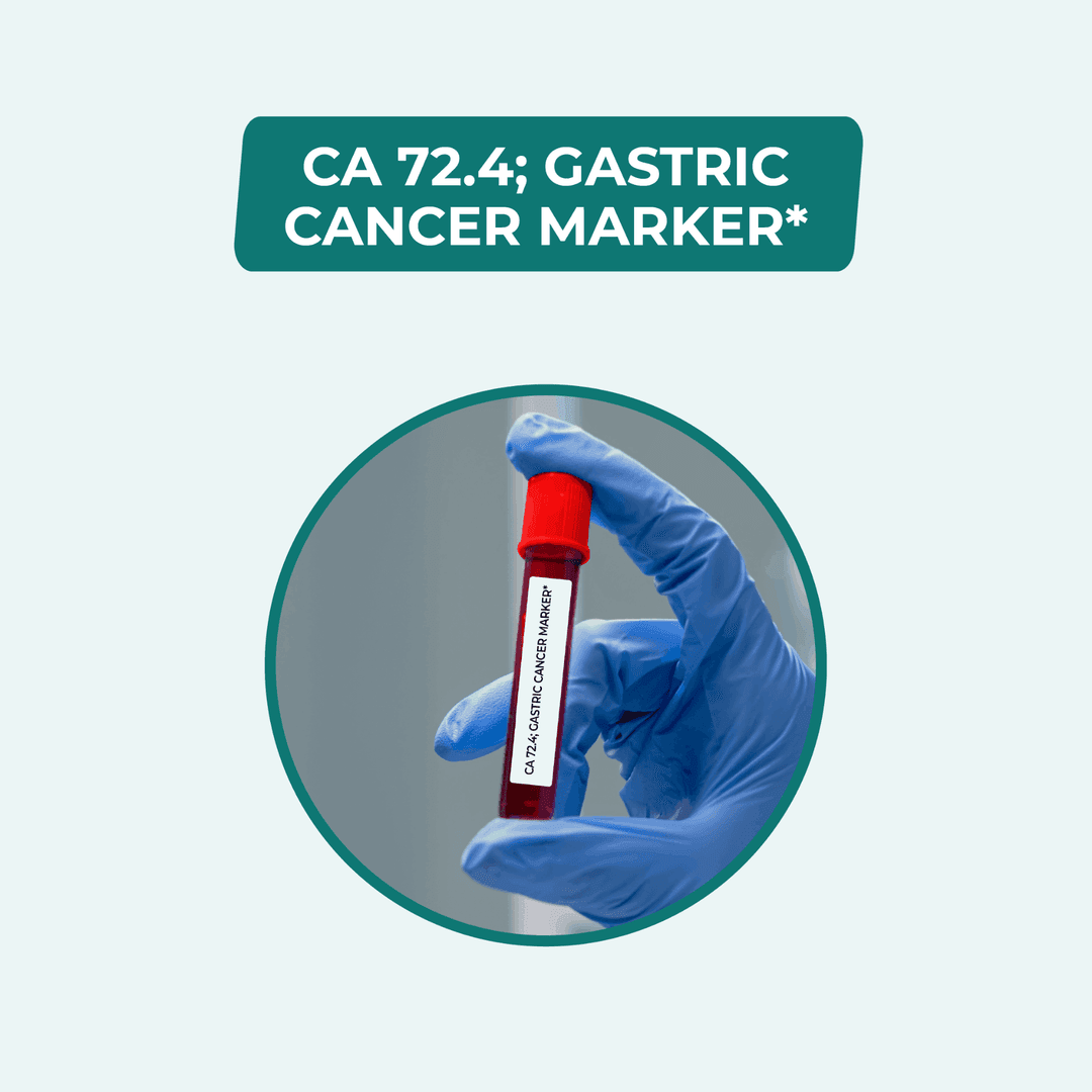 CA 72.4 (GASTRIC CANCER MARKER)