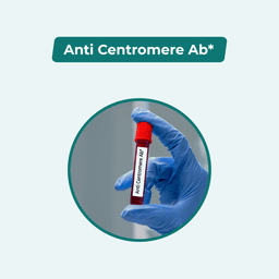 Anti Centromere Ab