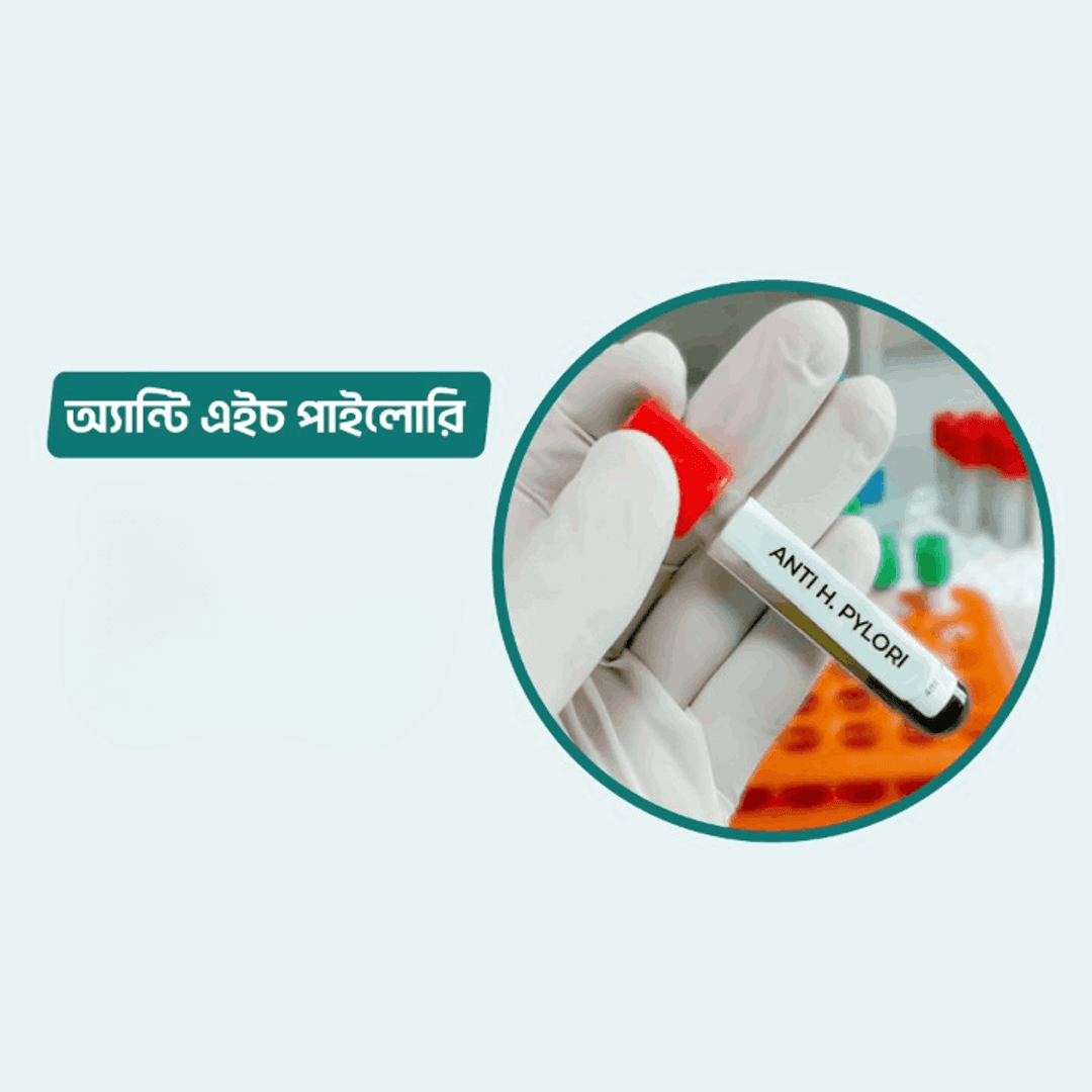 Stool for H. Pylori Antigen