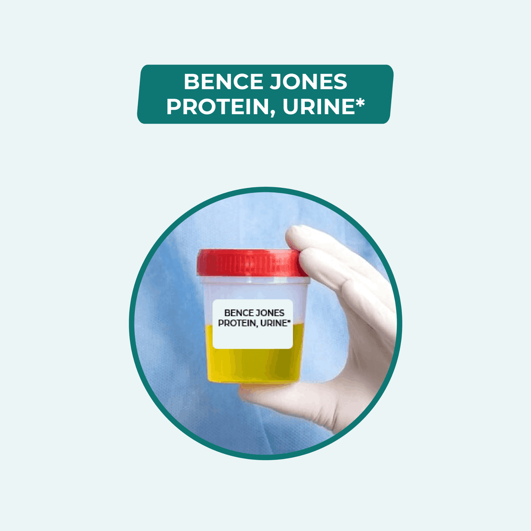 Bence Jones Protein, Urine