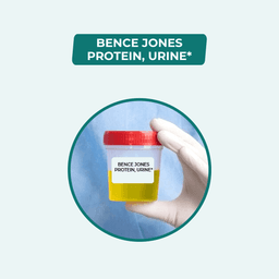 Bence Jones Protein, Urine