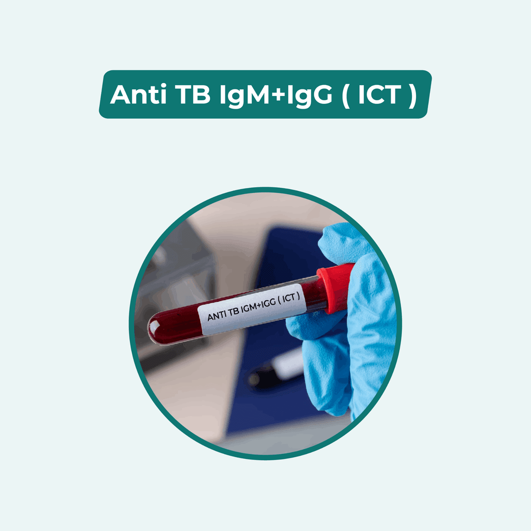Anti TB IgM+IgG ( ICT )