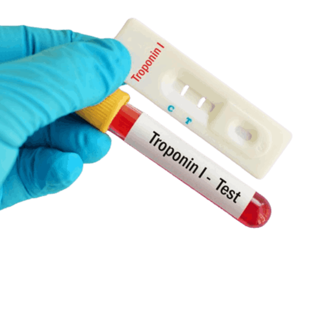 Troponin - I