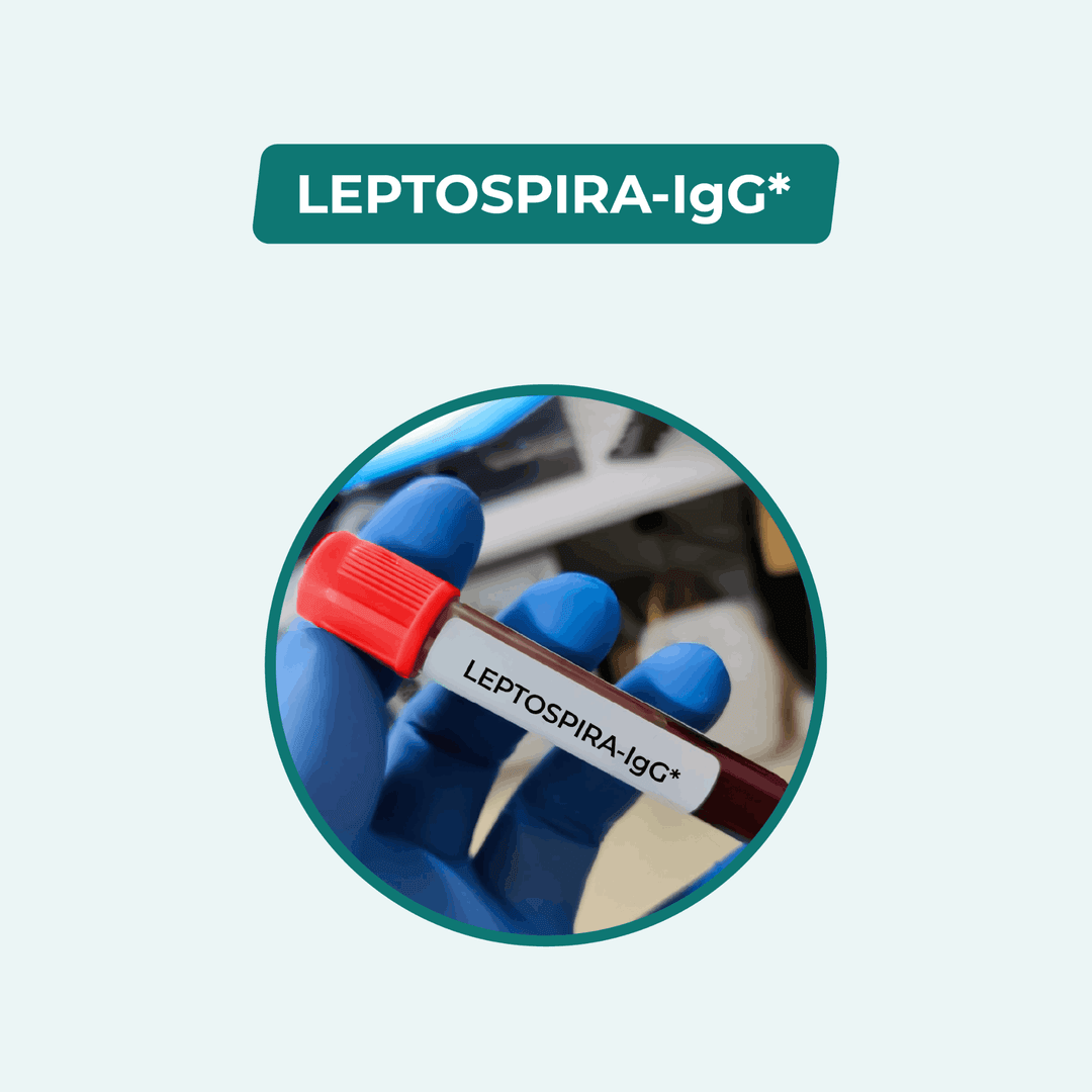 LEPTOSPIRA-IgG