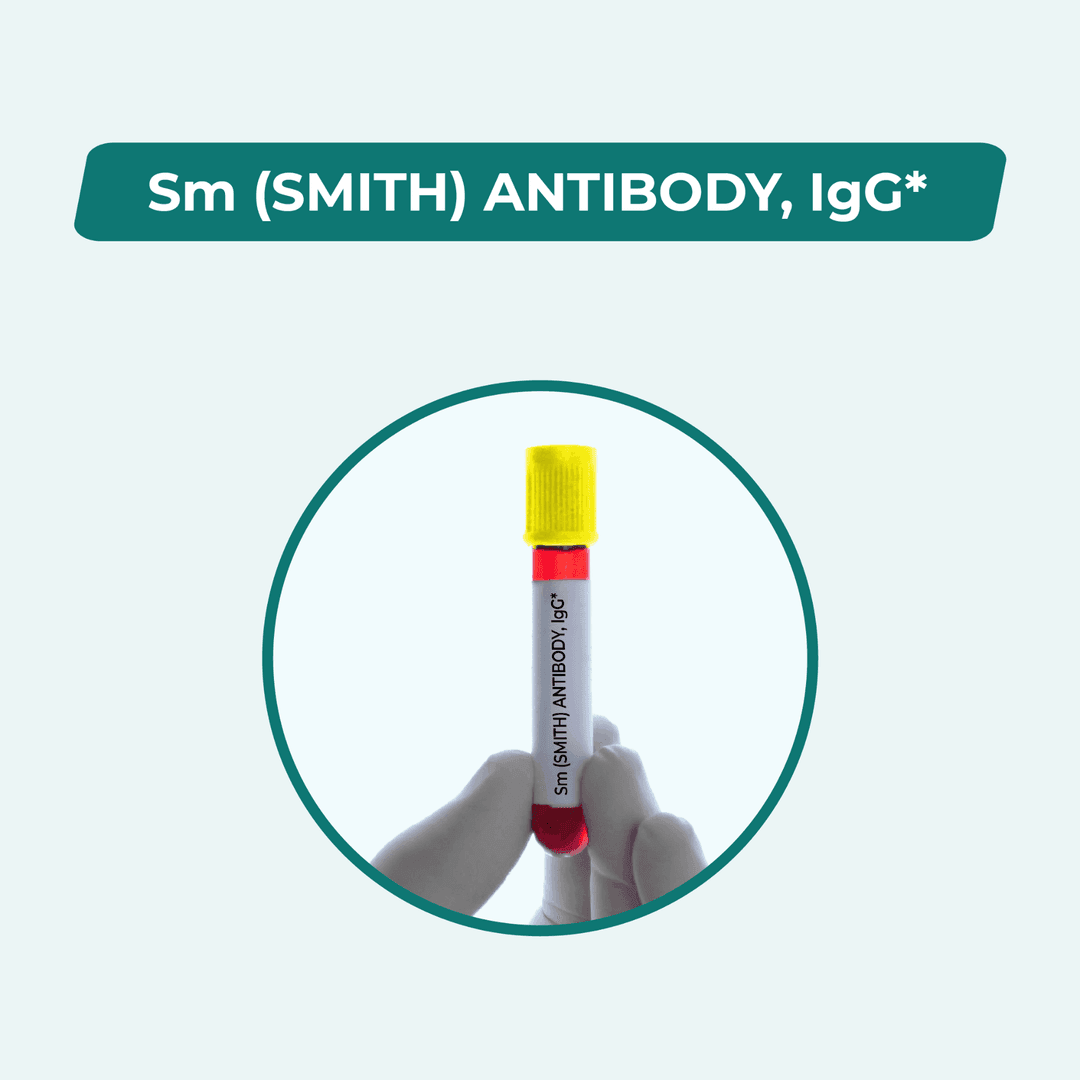Sm (SMITH) ANTIBODY, IgG