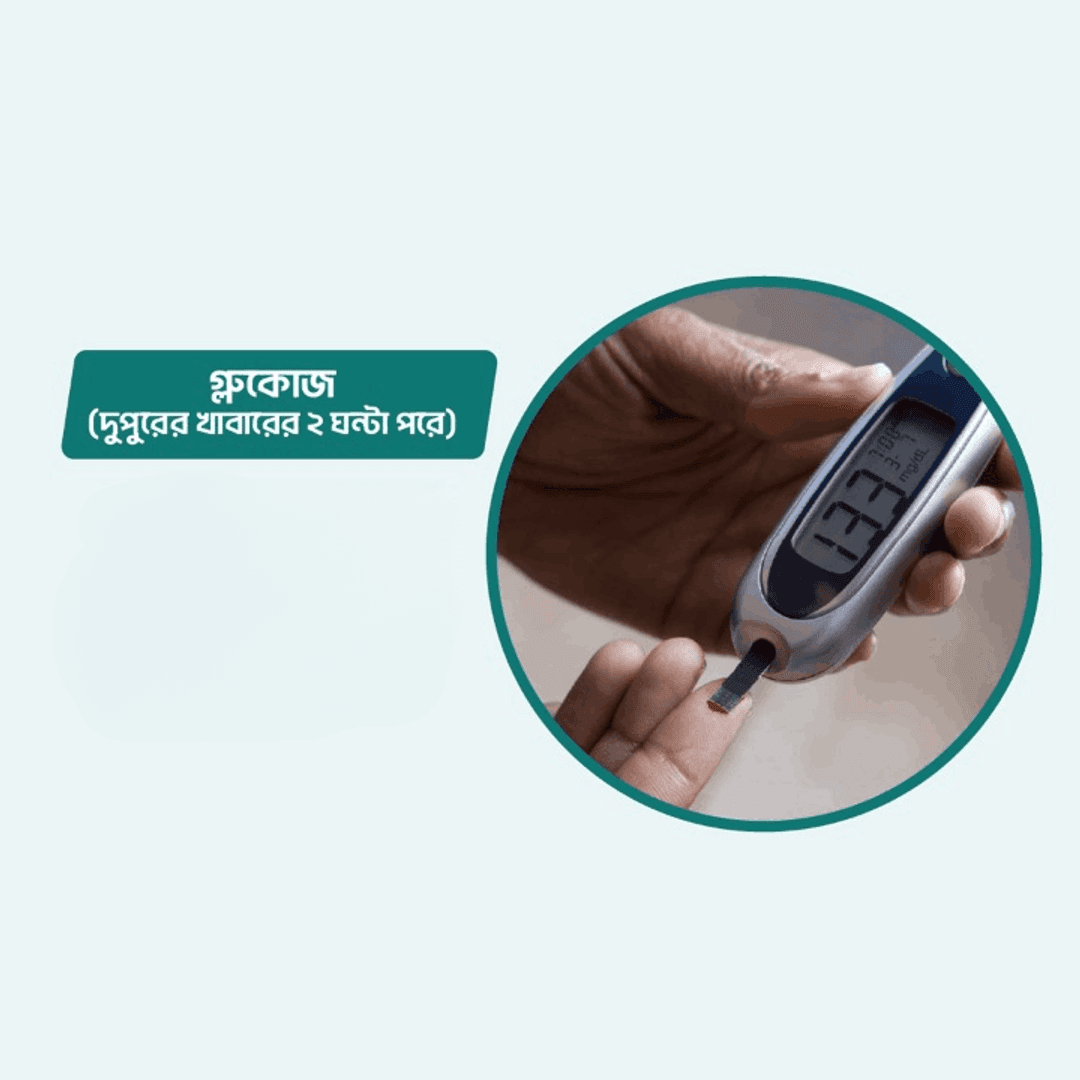 Glucose (2 Hours After Lunch)/2 Hours After Meal