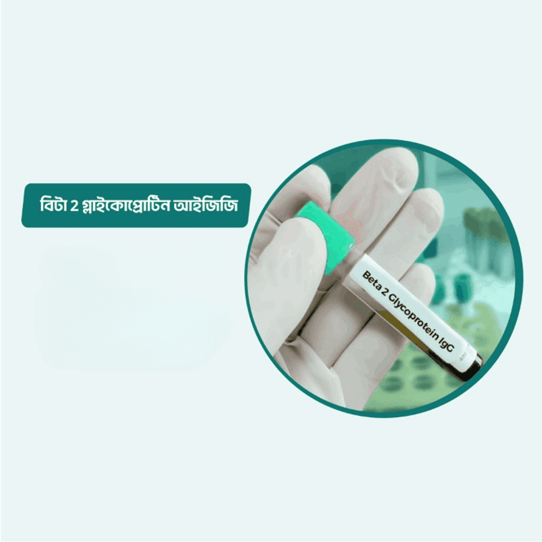 Beta 2 Glycoprotein IgG/Anti-B-2 Glycoprotein IgG