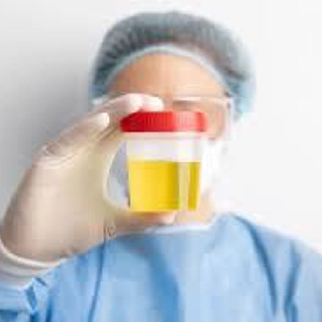Urine PH Test/Urine for PH
