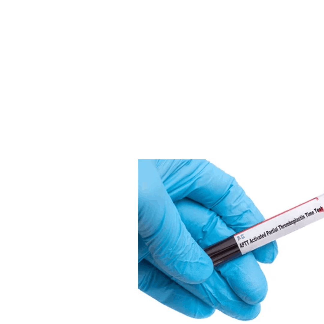 Activated Partial Thrombin Time (APTT)