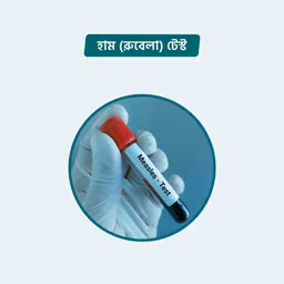 Measles (Rubeola) Antibodies Panel: IgG & IgM