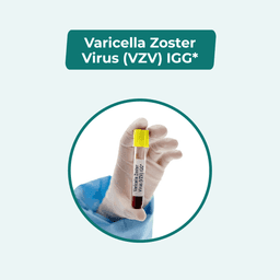 Varicella Zoster Virus (VZV) IgG