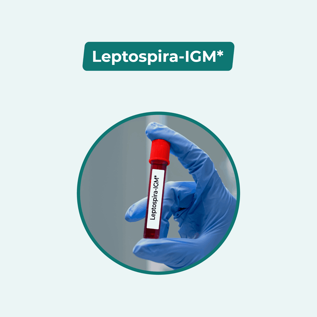 Leptospira-IGM