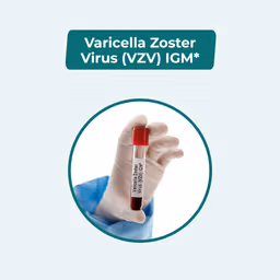 Varicella Zoster Virus (VZV) IgM