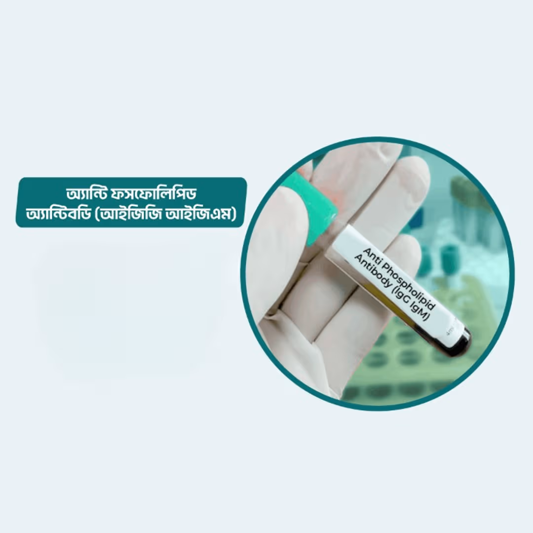 Anti Phospholipid Antibody (IgG IgM)