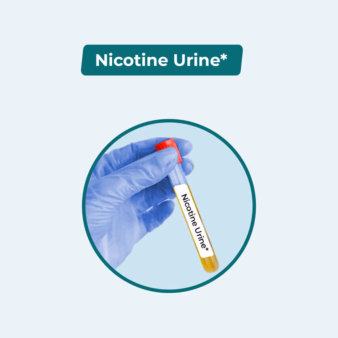 Nicotine Urine