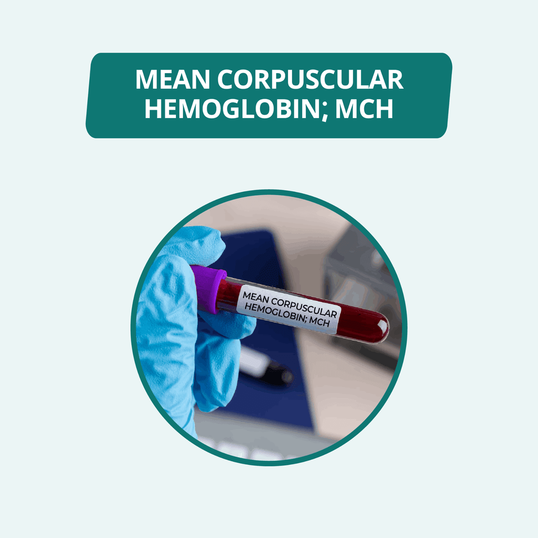 MEAN CORPUSCULAR HEMOGLOBIN; MCH