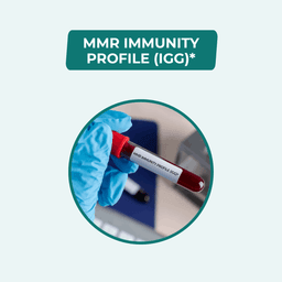 MMR Immunity Profile (IgG) Test