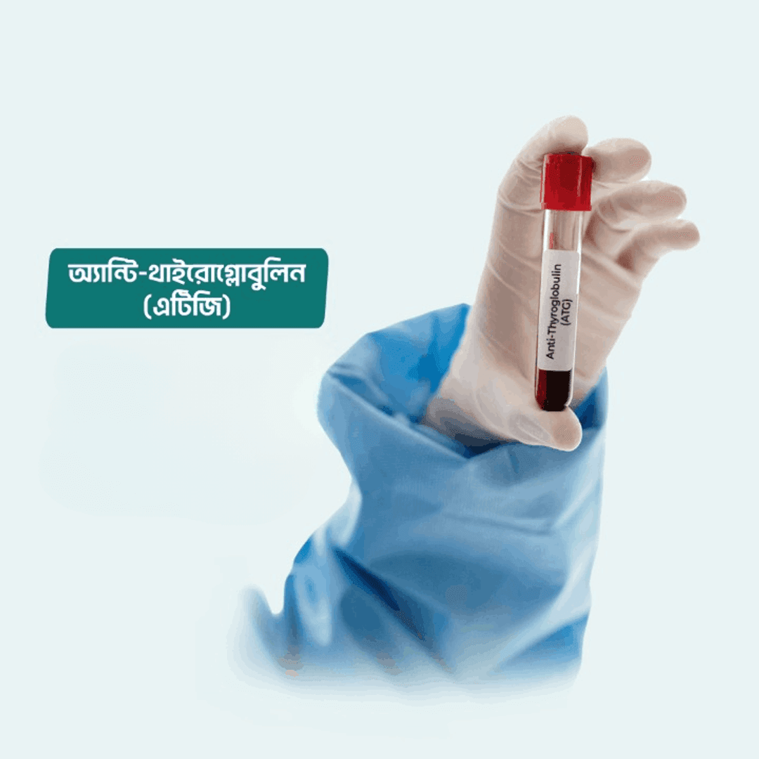 Anti Thyroglobulin (ATG)