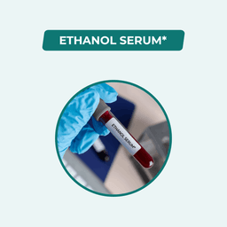 Serum Ethanol