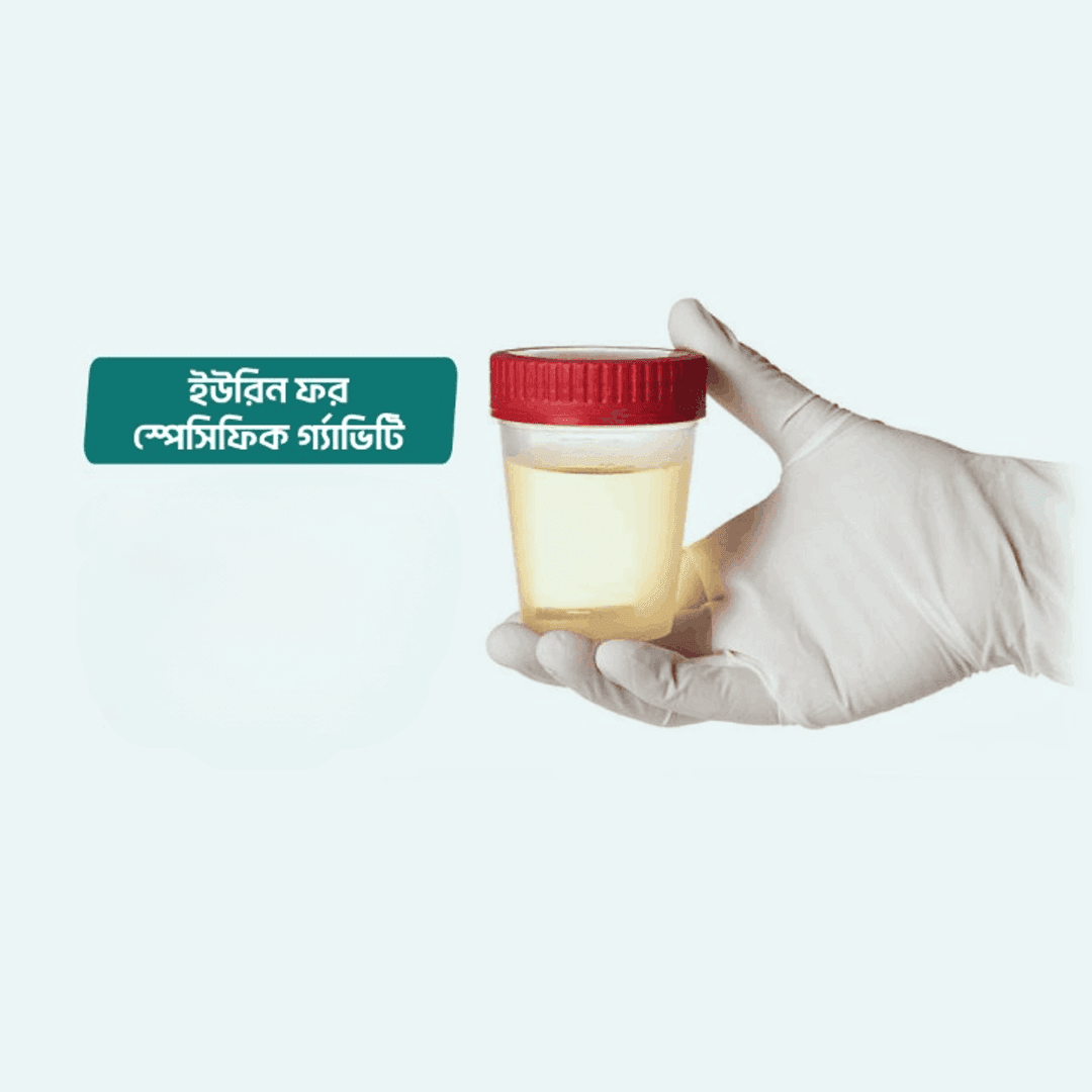 Urine for Specific Gravity