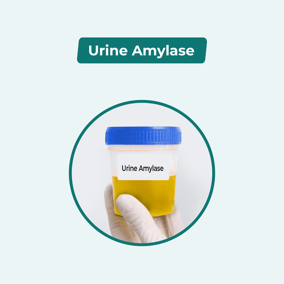 Urine Amylase
