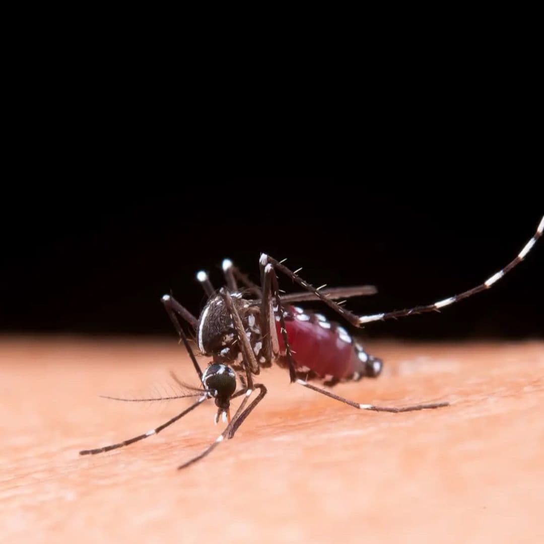 Zika Virus Antibody Test (IgM)