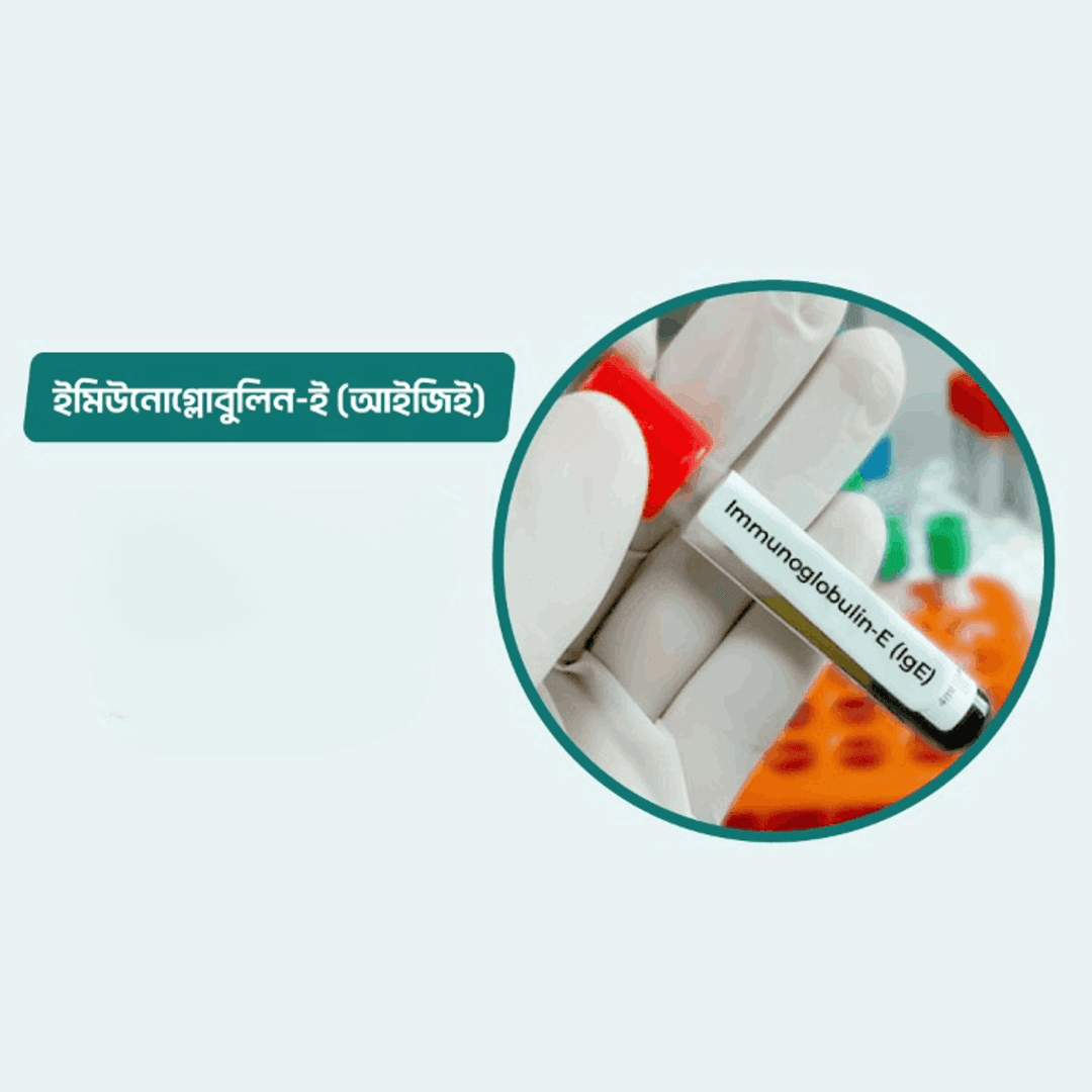 Immunoglobulin-E (IgE)