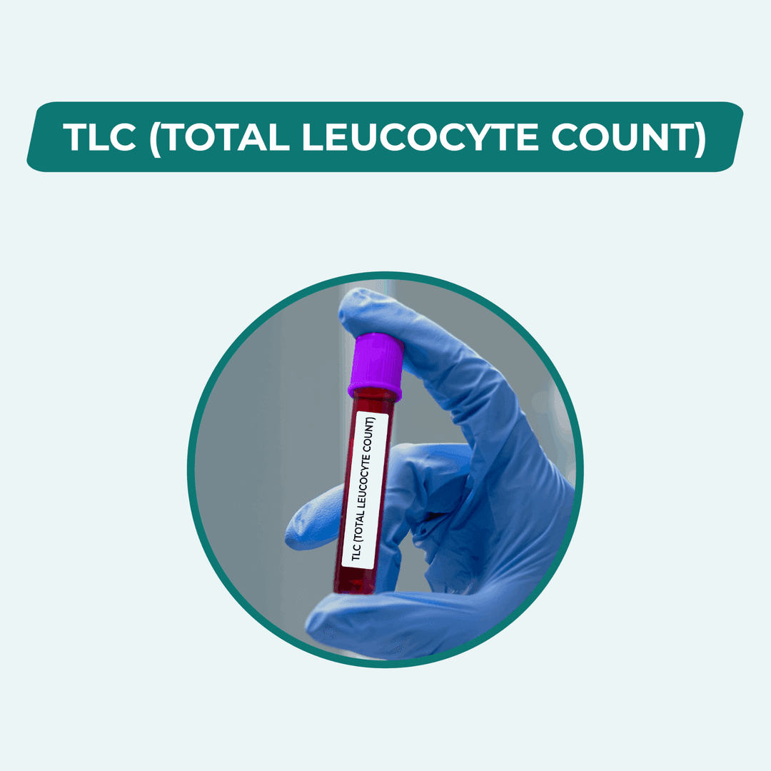 TLC (TOTAL LEUCOCYTE COUNT)