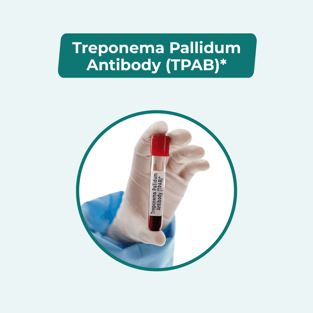 Treponema Pallidum Antibody (TPAB)