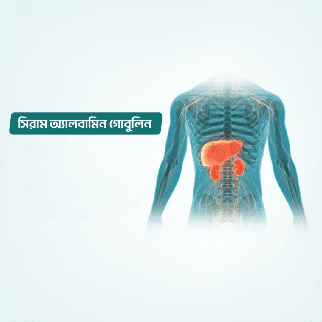 Albumin Globulin Ratio