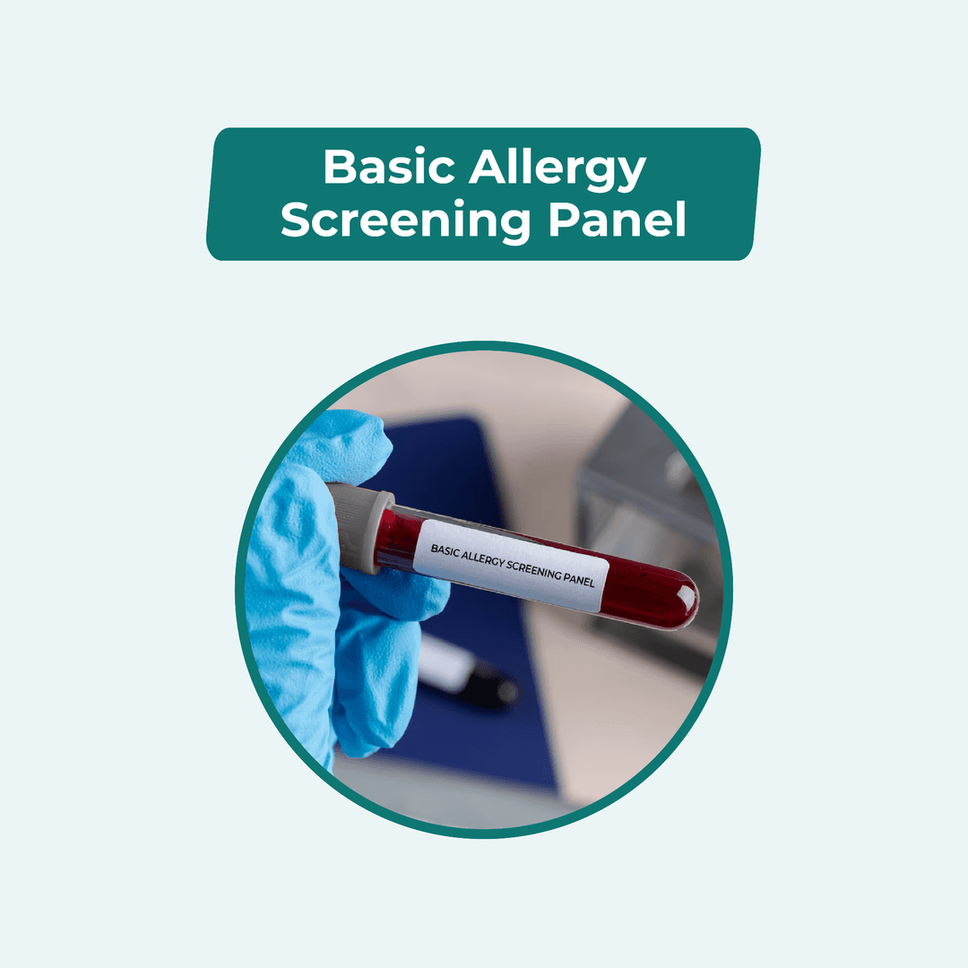 Basic Allergy Screening Panel
