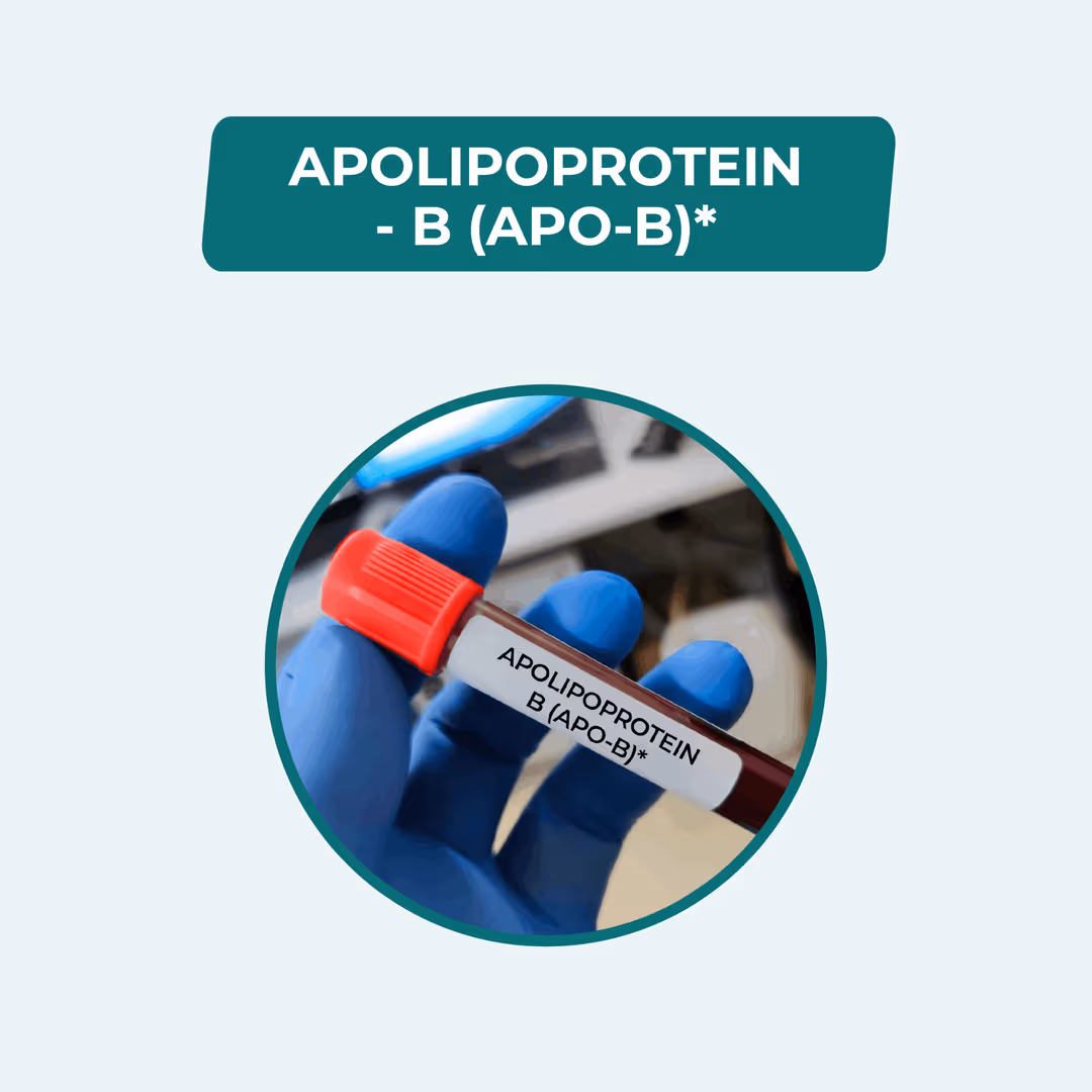 Apolipoproteins B (APO-B)